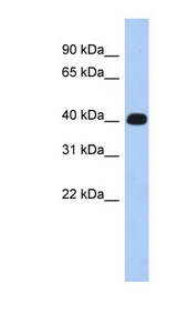ERMN / Juxtanodin Antibody - ERMN / KIAA1189 antibody Western blot of Fetal Muscle lysate. This image was taken for the unconjugated form of this product. Other forms have not been tested.