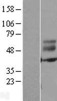 ERMN / Juxtanodin Protein - Western validation with an anti-DDK antibody * L: Control HEK293 lysate R: Over-expression lysate