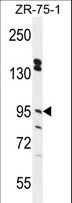 ERMP1 Antibody - ERMP1 Antibody western blot of ZR-75-1 cell line lysates (35 ug/lane). The ERMP1 antibody detected the ERMP1 protein (arrow).