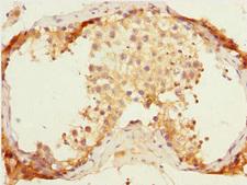 ERMP1 Antibody - Immunohistochemistry of paraffin-embedded human testis tissue at dilution 1:100