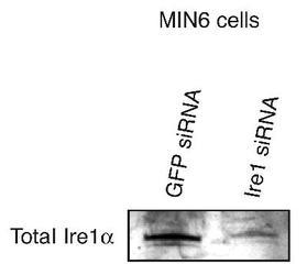 ERN1 / IRE1 Antibody - Detection of Ire1 alpha in transfected Min6 cells.  This image was taken for the unconjugated form of this product. Other forms have not been tested.