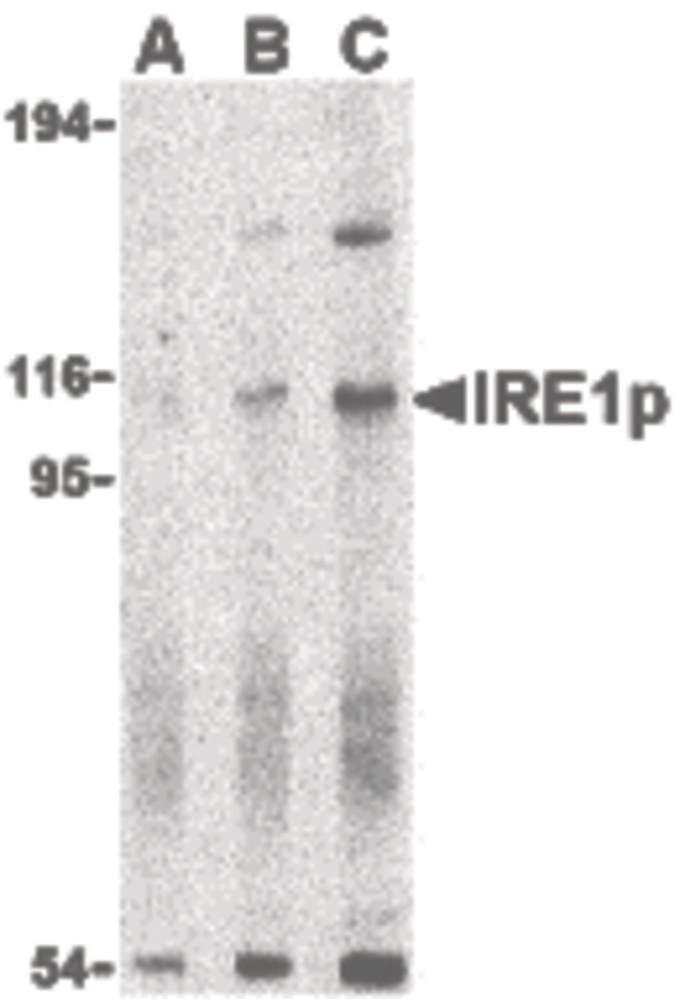 ERN1 / IRE1 Antibody - Western blot of IRE1p in A-20 cell lysate with IRE1p antibody at (A) 0.5, (B) 1 and (C) 2 ug/ml.
