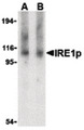 ERN1 / IRE1 Antibody - Western blot of IRE1p in Raji cell lysate with IRE1p antibody at (A) 1 and (B) 2 ug/ml.