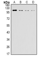 ERN1 / IRE1 Antibody - Western blot analysis of IRE1 expression in Raji (A), Jurkat (B), Hela(C), HEK293T (D) whole cell lysates.