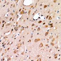 ERN1 / IRE1 Antibody - Immunohistochemical analysis of IRE1 staining in human brain formalin fixed paraffin embedded tissue section. The section was pre-treated using heat mediated antigen retrieval with sodium citrate buffer (pH 6.0). The section was then incubated with the antibody at room temperature and detected using an HRP conjugated compact polymer system. DAB was used as the chromogen. The section was then counterstained with haematoxylin and mounted with DPX.