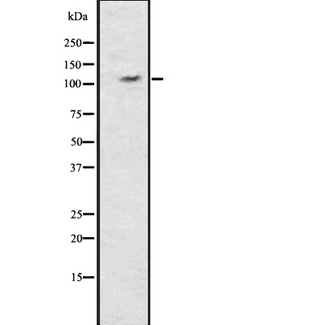 ERN1 / IRE1 Antibody - Western blot analysis of IRE1 using COLO205 whole lysates.