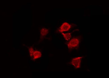 ERN1 / IRE1 Antibody - Staining HeLa cells by IF/ICC. The samples were fixed with PFA and permeabilized in 0.1% Triton X-100, then blocked in 10% serum for 45 min at 25°C. The primary antibody was diluted at 1:200 and incubated with the sample for 1 hour at 37°C. An Alexa Fluor 594 conjugated goat anti-rabbit IgG (H+L) Ab, diluted at 1/600, was used as the secondary antibody.