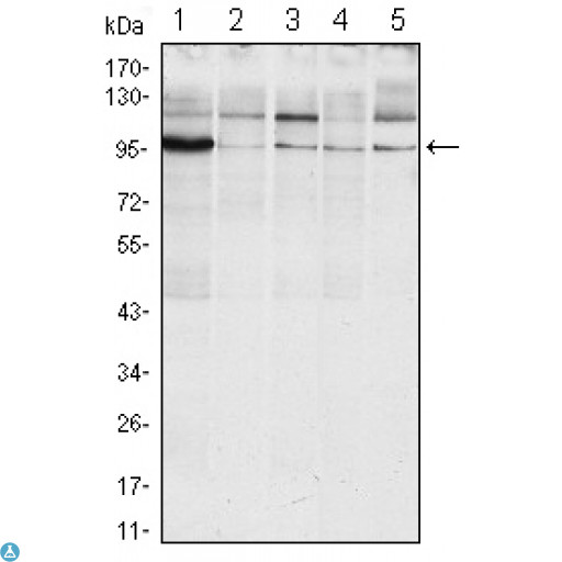 ERN1 / IRE1 Antibody - Western Blot (WB) analysis using IRE1alpha Monoclonal Antibody against Raji (1), A431 (2), Jurkat (3), HeLa(4) and HEK293 (5) cell lysate.