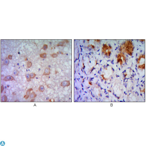 ERN1 / IRE1 Antibody - Immunohistochemistry (IHC) analysis of paraffin-embedded Human Brain tissue (A) and stomach tissue (B), showing cytoplasmic localization with DAB staining using IRE1alpha Monoclonal Antibody.