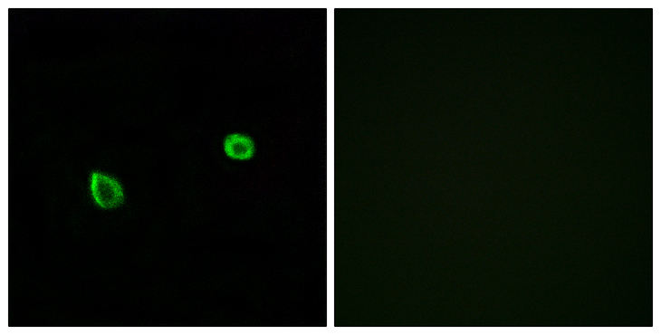 ERN2 Antibody - Immunofluorescence analysis of A549 cells, using ERN2 Antibody. The picture on the right is blocked with the synthesized peptide.
