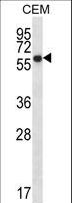 ERO1A / ERO1L Antibody - ERO1L Antibody western blot of CEM cell line lysates (35 ug/lane). The ERO1L antibody detected the ERO1L protein (arrow).