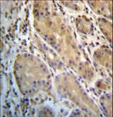 ERO1A / ERO1L Antibody - ERO1L Antibody immunohistochemistry of formalin-fixed and paraffin-embedded human stomach tissue followed by peroxidase-conjugated secondary antibody and DAB staining.