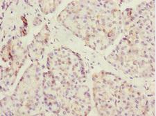 ERO1A / ERO1L Antibody - Immunohistochemistry of paraffin-embedded human pancreatic tissue at dilution 1:100