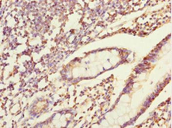 ERO1A / ERO1L Antibody - Immunohistochemistry of paraffin-embedded human small intestine tissue at dilution 1:100