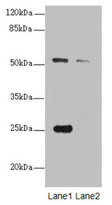 ERO1A / ERO1L Antibody - Western blot All Lanes:ERO1L antibody at 1.25ug/ml Lane 1 : A431 whole cell lysate Lane 2 : 293T whole cell lysate Secondary Goat polyclonal to Rabbit IgG at 1/10000 dilution Predicted band size: 54 kDa Observed band size: 54,25 kDa
