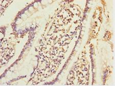 ERO1A / ERO1L Antibody - Immunohistochemistry of paraffin-embedded human small intestine tissue at dilution 1:100