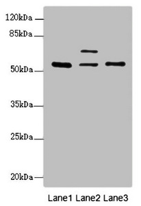 ERO1A / ERO1L Antibody - Western blot All Lanes:ERO1L antibody at 2.01ug/ml Lane 1 : HepG-2 whole cell lysate Lane 2 : Hela whole cell lysate Lane 3 : MCF7 whole cell lysate Secondary Goat polyclonal to Rabbit IgG at 1/10000 dilution Predicted band size: 54 kDa Observed band size: 54,62 kDa