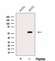 ERO1A / ERO1L Antibody - Western blot analysis of extracts of A431 cells using ERO1L antibody. The lane on the left was treated with blocking peptide.