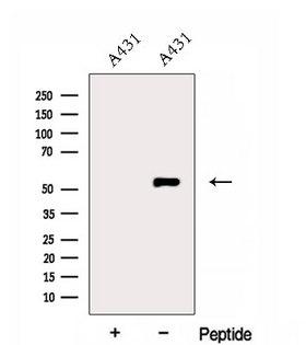 ERO1A / ERO1L Antibody - Western blot analysis of extracts of A431 cells using ERO1L antibody. The lane on the left was treated with blocking peptide.