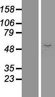 ERO1A / ERO1L Protein - Western validation with an anti-DDK antibody * L: Control HEK293 lysate R: Over-expression lysate
