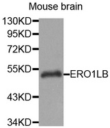 ERO1LB Antibody - Western blot analysis of extracts of Mouse brain cells.