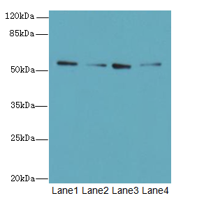 ERO1LB Antibody - Western blot. All lanes: ERO1B antibody at 3.2 ug/ml. Lane 1: MCF7 whole cell lysate. Lane 2: U251 whole cell lysate. Lane 3: Mouse liver tissue. Lane 4: U87 whole cell lysate. Secondary Goat polyclonal to Rabbit IgG at 1:10000 dilution. Predicted band size: 54 kDa. Observed band size: 54 kDa.