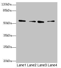 ERO1LB Antibody - Western blot All lanes: ERO1B antibody at 3.2µg/ml Lane 1: MCF-7 whole cell lysate Lane 2: U251 whole cell lysate Lane 3: Mouse liver tissue Lane 4: U87 whole cell lysate Secondary Goat polyclonal to rabbit IgG at 1/10000 dilution Predicted band size: 54, 17 kDa Observed band size: 54 kDa