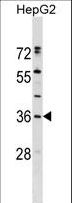 ERP27 Antibody - ERP27 Antibody western blot of HepG2 cell line lysates (35 ug/lane). The ERP27 antibody detected the ERP27 protein (arrow).