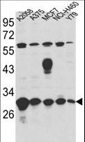 ERP29 Antibody - Western blot of ERP29 Antibody in A2058,A375,MCF7,NCI-H460,Y79 cell line lysates (35 ug/lane). ERP29 (arrow) was detected using the purified antibody.