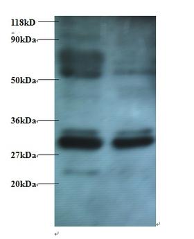 ERP29 Antibody - Western blot of Endoplasmic reticulum resident protein 29 antibody at 2 ug/ml. Lane 1: EC109 whole cell lysate. Lane 2: 293T whole cell lysate. Secondary: Goat polyclonal to Rabbit IgG at 1:15000 dilution. Predicted band size: 29 kDa. Observed band size: 29 kDa Additional bands at: 33 kDa, 55 kDa; We are unsure as to the identity of these extra bands.  This image was taken for the unconjugated form of this product. Other forms have not been tested.
