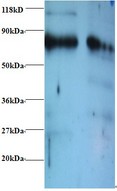 ERP29 Antibody - Western blot of Endoplasmic reticulum resident protein 29 antibody at 2 ug/ml. Lane 1: EC109whole cell lysate. Lane 2: 293T whole cell lysate. Secondary: Goat polyclonal to Rabbit IgG at 1:15000 dilution. Predicted band size: 29 kDa. Observed band size: 80 kDa.  This image was taken for the unconjugated form of this product. Other forms have not been tested.