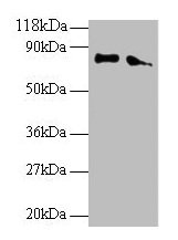 ERP29 Antibody - Western blot All lanes: Endoplasmic reticulum resident protein 29 antibody at 2µg/ml Lane 1: EC109whole cell lysate Lane 2: 293T whole cell lysate Secondary Goat polyclonal to rabbit IgG at 1/15000 dilution Predicted band size: 29, 6 kDa Observed band size: 80 kDa