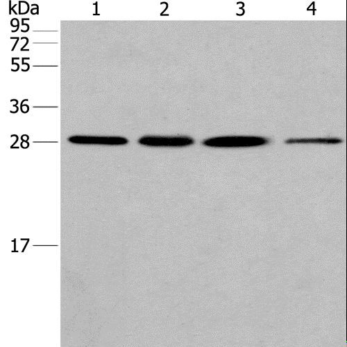 ERP29 Antibody - Western blot analysis of HeLa cell and human fetal liver tissue, A549 and 293T cell, using ERP29 Polyclonal Antibody at dilution of 1:200.