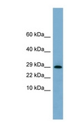 ERP29 Antibody - ERP29 antibody Western blot of ACHN lysate. This image was taken for the unconjugated form of this product. Other forms have not been tested.