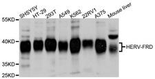 ERVFRD-1 / HERV-FRD Antibody - Western blot analysis of extracts of various cell lines, using ERVFRD-1 antibody at 1:1000 dilution. The secondary antibody used was an HRP Goat Anti-Rabbit IgG (H+L) at 1:10000 dilution. Lysates were loaded 25ug per lane and 3% nonfat dry milk in TBST was used for blocking. An ECL Kit was used for detection and the exposure time was 1s.