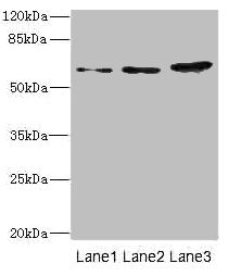 ERVFRD-1 / HERV-FRD Antibody - Western blot All Lanes: ERVFRD-1 antibody at 3.93ug/ml Lane 1: Hela whole cell lysate Lane 2: HepG-2 whole cell lysate Lane 3: A431 whole cell lysate Secondary Goat polyclonal to rabbit IgG at 1/10000 dilution Predicted band size: 60 kDa Observed band size: 60 kDa