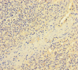 ESAM Antibody - Immunohistochemistry of paraffin-embedded human tonsil tissue using ESAM Antibody at dilution of 1:100