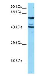 ESAM Antibody - ESAM antibody Western Blot of Jurkat.  This image was taken for the unconjugated form of this product. Other forms have not been tested.