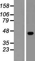 ESAM Protein - Western validation with an anti-DDK antibody * L: Control HEK293 lysate R: Over-expression lysate