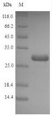 acpP / Acyl Carrier Protein Protein - (Tris-Glycine gel) Discontinuous SDS-PAGE (reduced) with 5% enrichment gel and 15% separation gel.