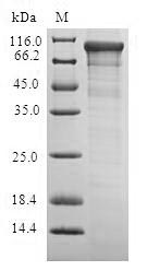 ADCY6 / Adenylate Cyclase 6 Protein - (Tris-Glycine gel) Discontinuous SDS-PAGE (reduced) with 5% enrichment gel and 15% separation gel.