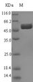 AGMAT Protein - (Tris-Glycine gel) Discontinuous SDS-PAGE (reduced) with 5% enrichment gel and 15% separation gel.