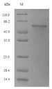 DBP5 / SON Protein - (Tris-Glycine gel) Discontinuous SDS-PAGE (reduced) with 5% enrichment gel and 15% separation gel.