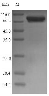 glcB Protein - (Tris-Glycine gel) Discontinuous SDS-PAGE (reduced) with 5% enrichment gel and 15% separation gel.