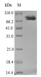 htpG Protein - (Tris-Glycine gel) Discontinuous SDS-PAGE (reduced) with 5% enrichment gel and 15% separation gel.