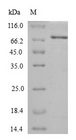 htpG Protein - (Tris-Glycine gel) Discontinuous SDS-PAGE (reduced) with 5% enrichment gel and 15% separation gel.