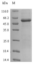 lacI Protein - (Tris-Glycine gel) Discontinuous SDS-PAGE (reduced) with 5% enrichment gel and 15% separation gel.