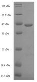 lepB Protein - (Tris-Glycine gel) Discontinuous SDS-PAGE (reduced) with 5% enrichment gel and 15% separation gel.