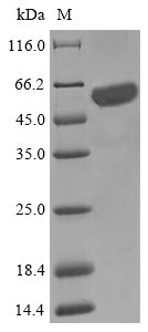 NFS1 Protein - (Tris-Glycine gel) Discontinuous SDS-PAGE (reduced) with 5% enrichment gel and 15% separation gel.