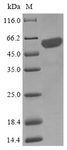 NFS1 Protein - (Tris-Glycine gel) Discontinuous SDS-PAGE (reduced) with 5% enrichment gel and 15% separation gel.